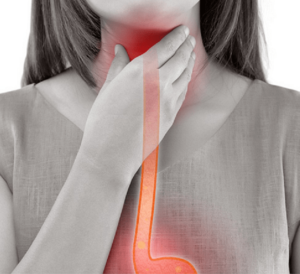 achalasia, achalasia causes, achalasia symptoms-5265848.jpg